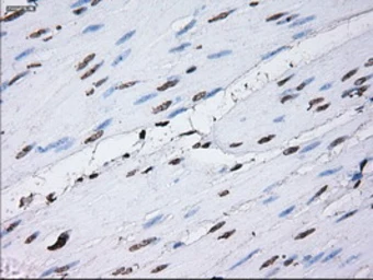 Anti-ID3 antibody [15F4] used in IHC (Paraffin sections) (IHC-P). GTX84320