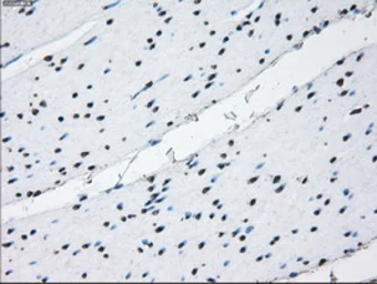 Anti-ID3 antibody [15F4] used in IHC (Paraffin sections) (IHC-P). GTX84320