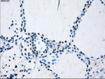 Anti-ID3 antibody [15F4] used in IHC (Paraffin sections) (IHC-P). GTX84320