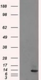 Anti-ID3 antibody [15F4] used in Western Blot (WB). GTX84320