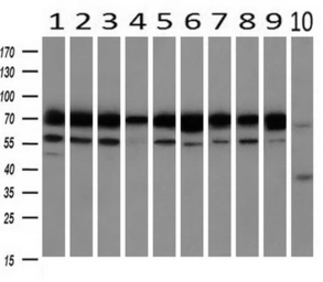 Anti-Grp75 antibody [4A1] used in Western Blot (WB). GTX84330