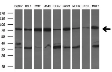 Anti-Grp75 antibody [10D7] used in Western Blot (WB). GTX84332