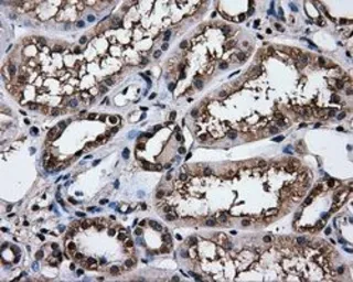 Anti-Hsp70 antibody [2C12] used in IHC (Paraffin sections) (IHC-P). GTX84341