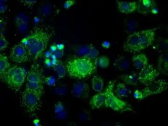 Anti-ERAB antibody [5E2] used in Immunocytochemistry/ Immunofluorescence (ICC/IF). GTX84344