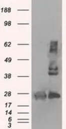 Anti-ERAB antibody [5E2] used in Western Blot (WB). GTX84344