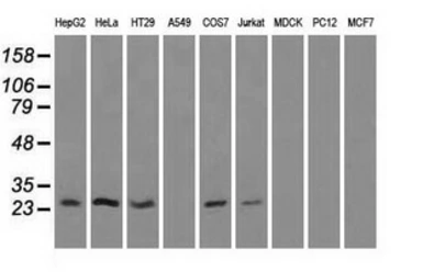 Anti-ERAB antibody [5E2] used in Western Blot (WB). GTX84344