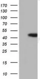 Anti-Haptoglobin antibody [2B11] used in Western Blot (WB). GTX84348