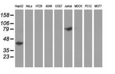 Anti-Haptoglobin antibody [1B1] used in Western Blot (WB). GTX84351
