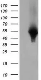 Anti-Haptoglobin antibody [4H5] used in Western Blot (WB). GTX84352