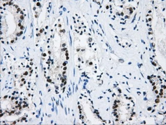 Anti-hnRNP F antibody [5F5] used in IHC (Paraffin sections) (IHC-P). GTX84356