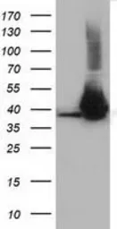 Anti-HIBCH antibody [4G1] used in Western Blot (WB). GTX84368