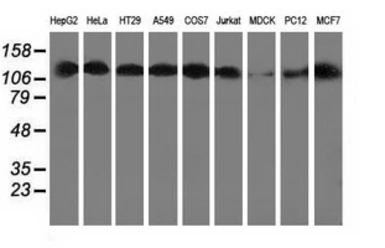 Anti-HDAC6 antibody [1D11] used in Western Blot (WB). GTX84379