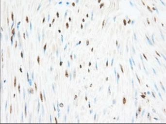 Anti-H6PD antibody [2A7] used in IHC (Paraffin sections) (IHC-P). GTX84395