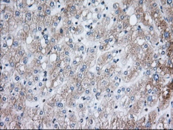 Anti-H6PD antibody [2A7] used in IHC (Paraffin sections) (IHC-P). GTX84395