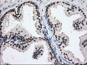 Anti-H6PD antibody [2A7] used in IHC (Paraffin sections) (IHC-P). GTX84395