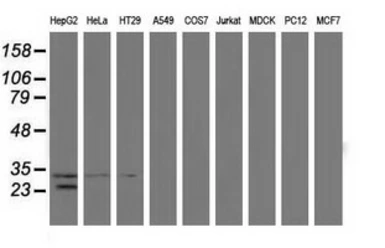 Anti-GSTT2 antibody [8A10] used in Western Blot (WB). GTX84398