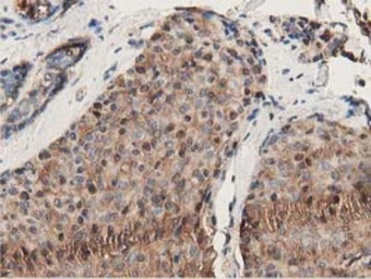 Anti-GSTT2 antibody [2E3] used in IHC (Paraffin sections) (IHC-P). GTX84400