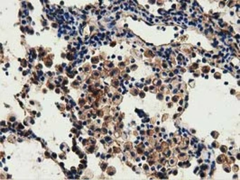 Anti-GSTT2 antibody [2E3] used in IHC (Paraffin sections) (IHC-P). GTX84400