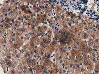 Anti-GSTT2 antibody [2E3] used in IHC (Paraffin sections) (IHC-P). GTX84400