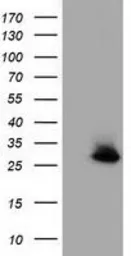 Anti-GSTT2 antibody [2E3] used in Western Blot (WB). GTX84400