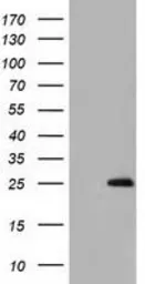 Anti-GSTA4 antibody [1E2] used in Western Blot (WB). GTX84404