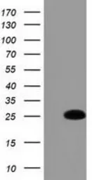 Anti-GSTA4 antibody [3F5] used in Western Blot (WB). GTX84405