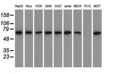 Anti-GPI antibody [5A11] used in Western Blot (WB). GTX84416