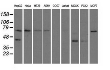 Anti-GRASP65 antibody [5C5] used in Western Blot (WB). GTX84423