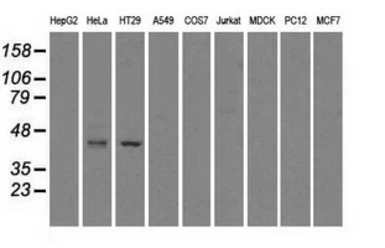 Anti-Glutamine synthetase antibody [1F4] used in Western Blot (WB). GTX84426
