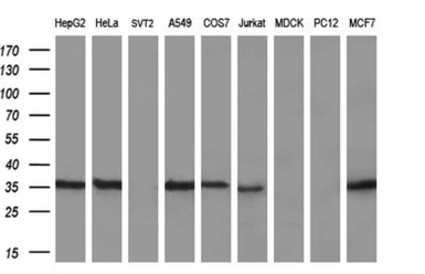 Anti-GGPS1 antibody [3F9] used in Western Blot (WB). GTX84427