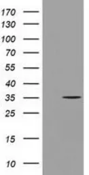 Anti-GGPS1 antibody [3F9] used in Western Blot (WB). GTX84427