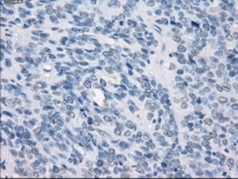 Anti-GBP2 antibody [1E5] used in IHC (Paraffin sections) (IHC-P). GTX84445