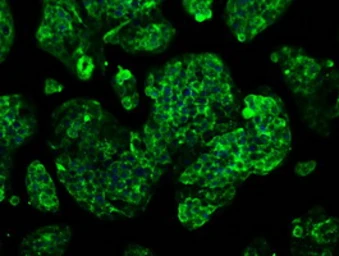 Anti-GBE1 antibody [1D11] used in Immunocytochemistry/ Immunofluorescence (ICC/IF). GTX84452