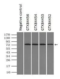 Anti-GBE1 antibody [4D9] used in Immunoprecipitation (IP). GTX84453
