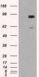 Anti-GBE1 antibody [4D9] used in Western Blot (WB). GTX84453
