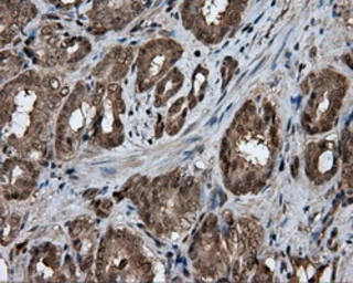 Anti-GBE1 antibody [3B4] used in IHC (Paraffin sections) (IHC-P). GTX84456