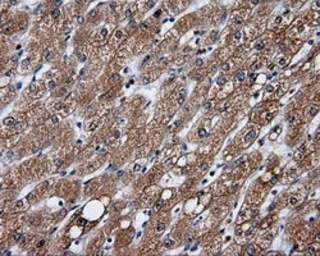 Anti-GBE1 antibody [3B4] used in IHC (Paraffin sections) (IHC-P). GTX84456