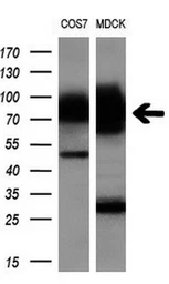 Anti-GBE1 antibody [3B4] used in Western Blot (WB). GTX84456