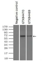 Anti-GAD67 antibody [3G9] used in Immunoprecipitation (IP). GTX84469