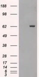 Anti-GAD67 antibody [3G9] used in Western Blot (WB). GTX84469