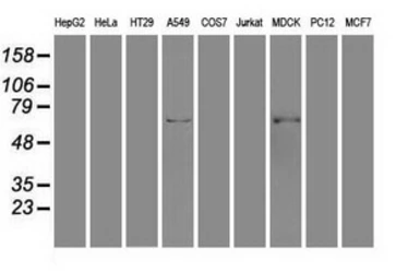Anti-GAD67 antibody [3H2] used in Western Blot (WB). GTX84470