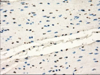 Anti-FRK antibody [6D2] used in IHC (Paraffin sections) (IHC-P). GTX84481