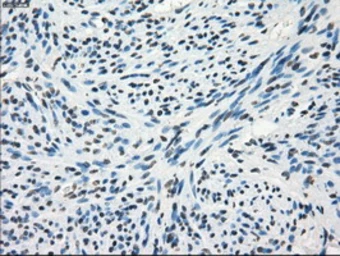 Anti-FRK antibody [6D2] used in IHC (Paraffin sections) (IHC-P). GTX84481