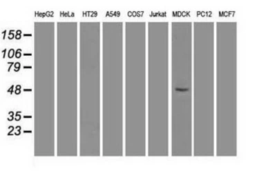 Anti-FOXA1 antibody [3C1] used in Western Blot (WB). GTX84486