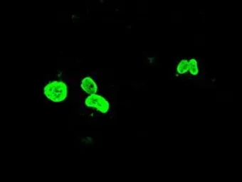 Anti-FOXA1 antibody [3A8] used in Immunocytochemistry/ Immunofluorescence (ICC/IF). GTX84487