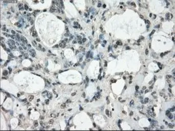 Anti-FRA1 antibody [12F9] used in IHC (Paraffin sections) (IHC-P). GTX84488