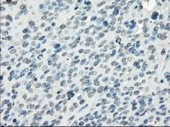 Anti-FRA1 antibody [12F9] used in IHC (Paraffin sections) (IHC-P). GTX84488