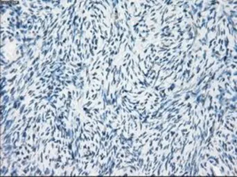 Anti-FRA1 antibody [12F9] used in IHC (Paraffin sections) (IHC-P). GTX84488