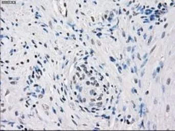 Anti-FRA1 antibody [12F9] used in IHC (Paraffin sections) (IHC-P). GTX84488