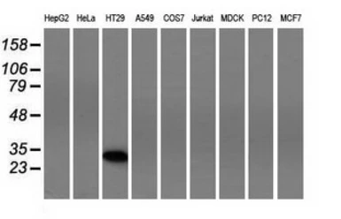 Anti-FHL1 antibody [1D6] used in Western Blot (WB). GTX84495